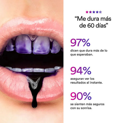 Obsessive Shine® –  Transforma tu sonrisa en solo 7 noches